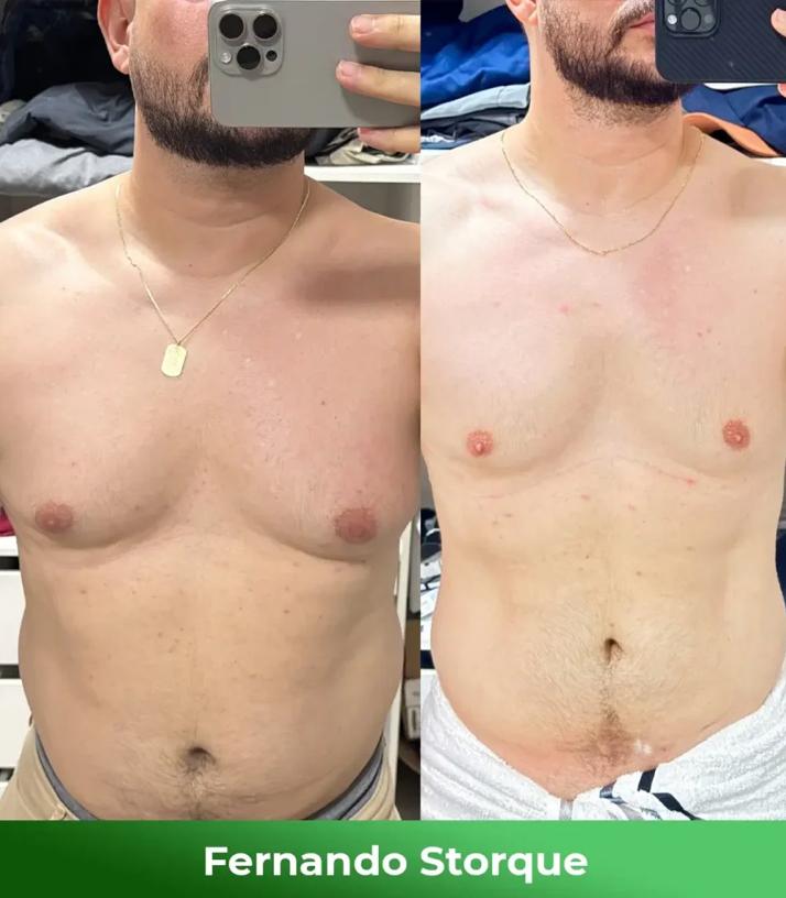 Resultado 1
